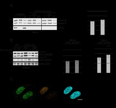 Figure Supplement 1 Nucleoplasmic Lamins A And C Are More Resistant