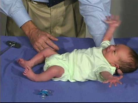 Pediatric Neurologic Examination Videos Descriptions Newborn