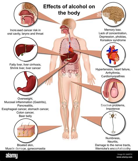 Effects Of Alcohol Hi Res Stock Photography And Images Alamy