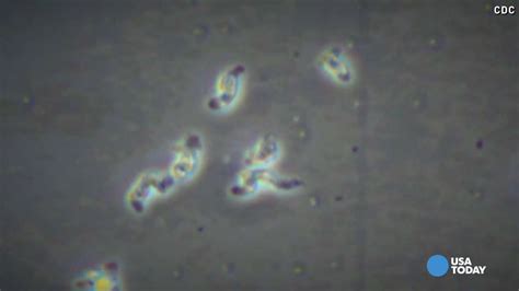 Brain Eating Amoeba Found In Louisiana Water