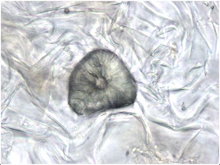 Difference Between Fibres and Sclereids | Compare the Difference ...