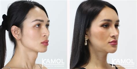 Kamol Cosmetic Hospital