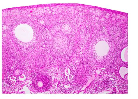 Ovary Histology I Diagram Quizlet