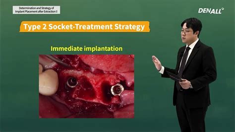 Master Course Basic Ep 15 Determination And Strategy Of Implant