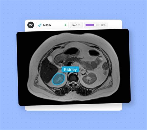 Ai In Radiology Pros And Cons Applications And 4 Examples