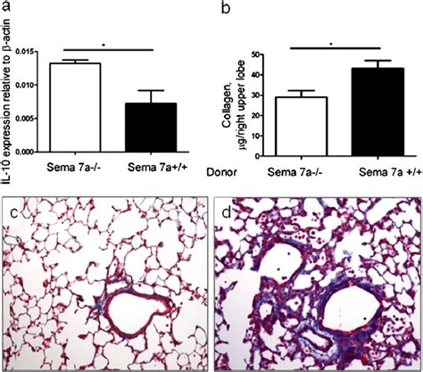 A Compared With In Vitro Generated Tregs Obtained From Semaphorin A