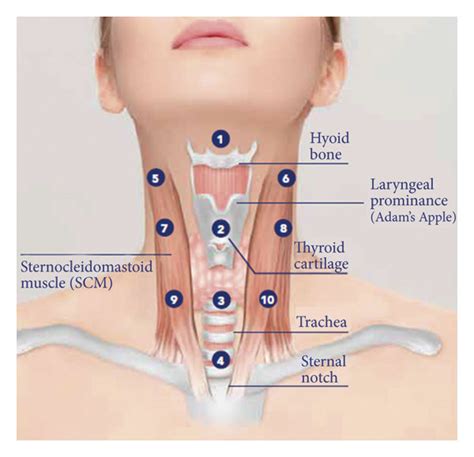 Schematic Representation Of The 10 Injection Points Used In This Study