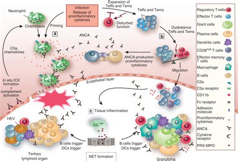 New Pathophysiological Insights And Treatment Of ANCA Associated