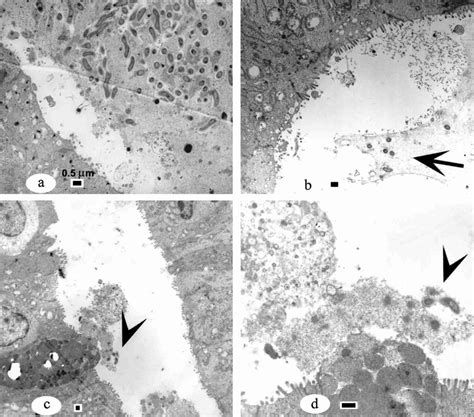 Electron Micrograph Of The Follicle Associated Epithelium Of A