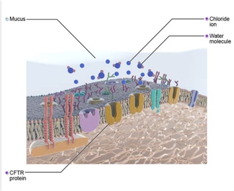 Cystic Fibrosis A Comprehensive Overview