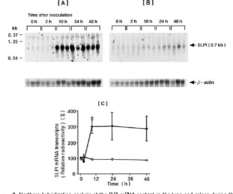 Figure 3 From Bacterial Pneumonia Causes Augmented Expression Of The