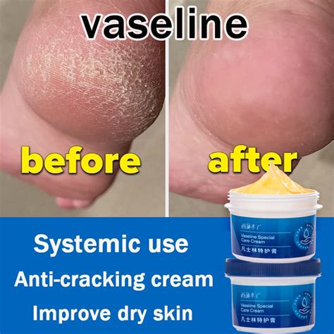 Vaseline Anti Cracking Foot Cream Anti Chapped Moisturizing Hand Cream