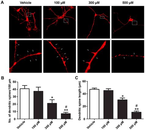 Ketamine Destabilizes Growth Of Dendritic Spines In Developing