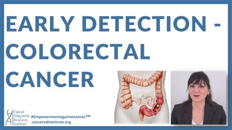 How Is Colorectal Cancer Detected Early Detection Of Colorectal Cancer