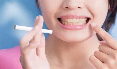 Does Chewing Tobacco Affect Teeth Whitening