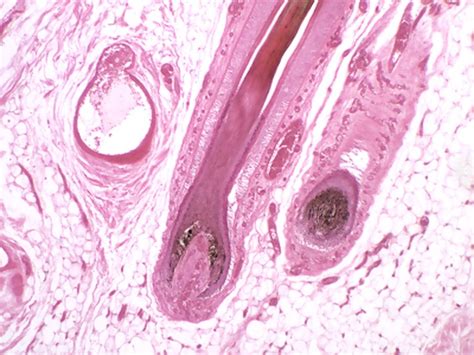 Solved What type of tissue? | Chegg.com 