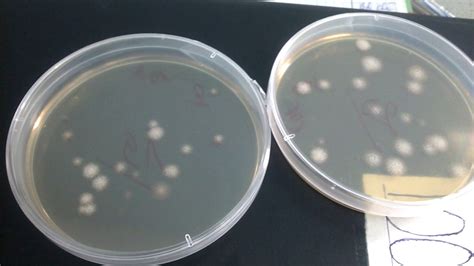 Colony Of Bacillus Subtilis In B Media Youtube