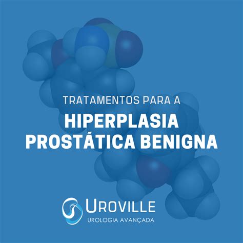 Arquivos Próstata Urologista Curitiba Uroville