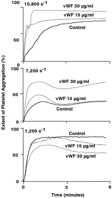 Enhanced Shear Induced Platelet Aggregation In Acute Myocardial