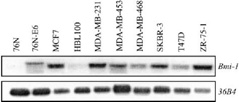 Figure 1 From The Bmi 1 Oncogene Induces Telomerase Activity And