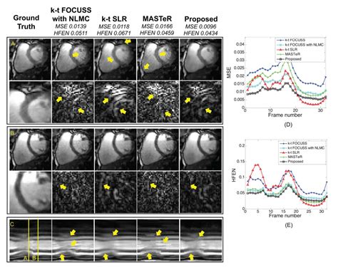 Nanoscopy - Bio Imaging, Signal Processing & Learning (BISPL)