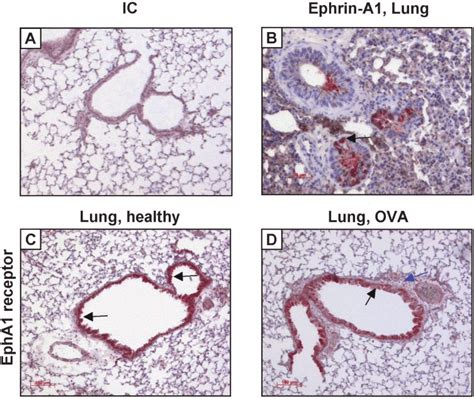 Immunohistological Staining Of Ephrin A1 And Epha1 Receptor A Download Scientific Diagram