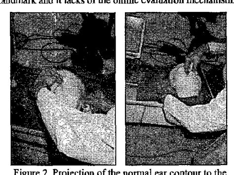 Figure 2 From Development Of Computer Aided Retained Auricular