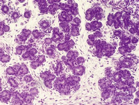 Development Of The Thyroid Gland Photograph by Jose Calvo / Science ...