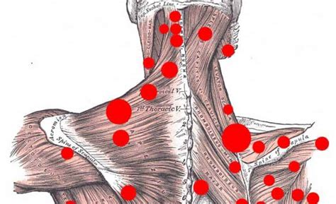 Punkty Spustowe Physio Soton