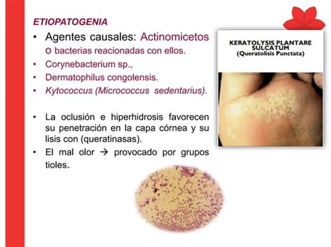 Molusco Contagioso Herpes Virus Y Queratolisis Plantar Dermatología