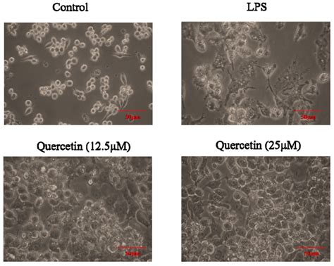 Morphology Of Raw Cells Induced With Lps G Ml Alone And