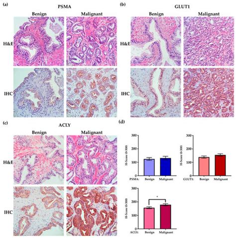 Ijms Free Full Text Prostate Specific Membrane Antigen Psma