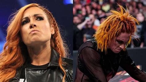 WWE RAW: Update on Becky Lynch's injury status - Reports