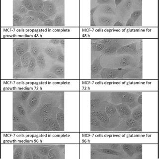 Light Microscopy Images Demonstrating Morphology Of MDA MB 231 Cells