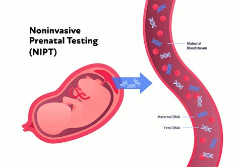 Prenatal Genetic Testing