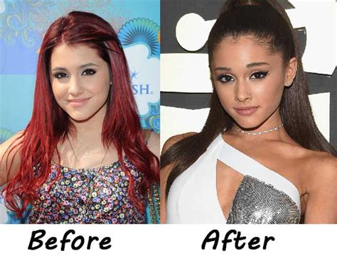 Ariana Grande Plastic Surgery: face modification,lose weight,rhinoplasty