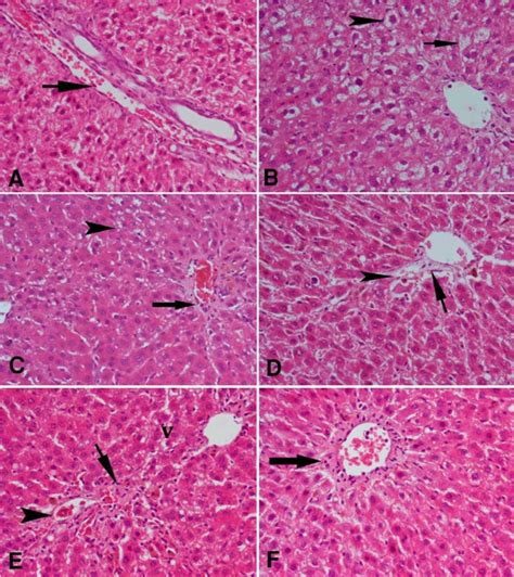 A Photomicrograph Of Sections Of Liver Tissue From A A Rat Received