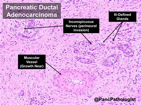 Pancreatic Duct Histology