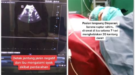 Viral Ibu Hamil Keguguran Dan Rahim Robek Setelah Konsumsi Rumput Fatimah