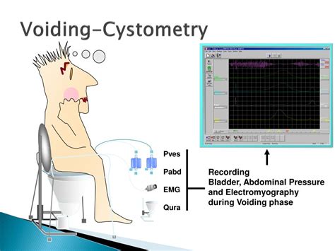 Ppt Urodynamic Assessment In Women With Urinary Incontinence