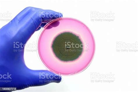 Fungus Isolated In The Microbiology Laboratory Fungal Infections By Pathogenic Fungi Stock Photo ...