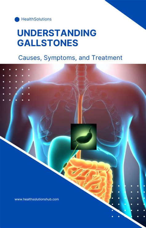 Understanding Gallstones Causes Symptoms And Treatment