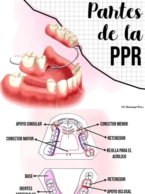 Conectores prótesis parcial removible acrílica funciones y tipos