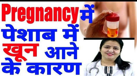 Pregnancy Me Blood Aane Se Kya Hota Hai Pregnancy Me Blood Kio Ata Hai