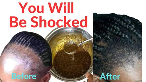 Regrow Lost Edges And Bald Spots Fast With This Magical Oil How To