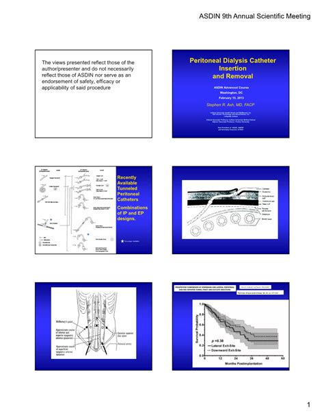 Peritoneal Dialysis Catheter Insertion and Removal - DocsLib