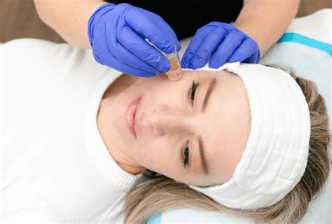 Prp Facial Platelet Rich Plasma Facial Or Vampire Facial