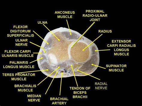 Filemuscles Of Upper Limbcross Section Human Cadaver Wikipedia