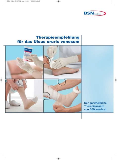 Pdf Therapieempfehlung F R Das Ulcus Cruris Venosum Dokumen Tips