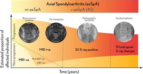 Non Radiographic Versus Radiographic Axspa Whats In A Name